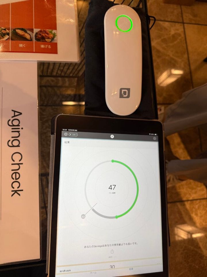 血管の糖化レベルがわかるAGEs（糖化年齢）測定：血管年齢は47歳でした