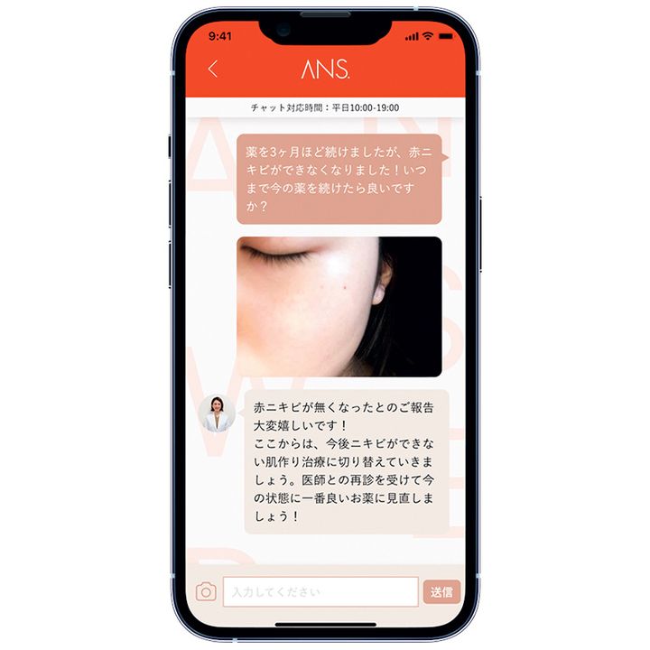 オンラインで完結する美肌治療サービスANS.のアプリ画面