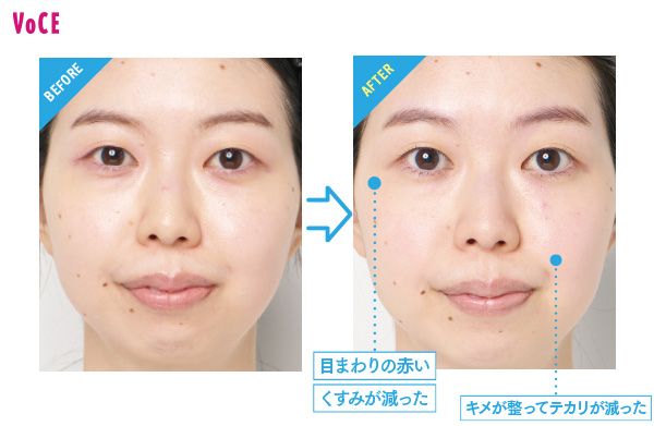 BEFORE→AFTER 目まわりの赤いくすみが減った キメが整ってテカリが減った