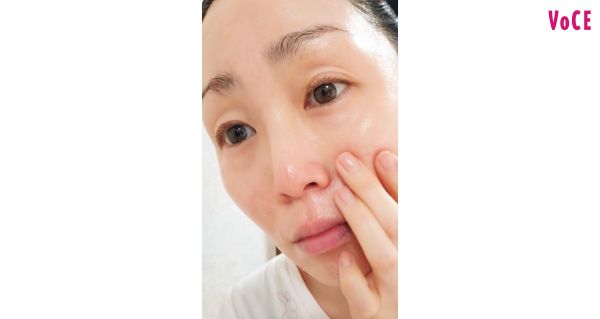 赤みが引いて明るく。鏡を見るのが楽しい！