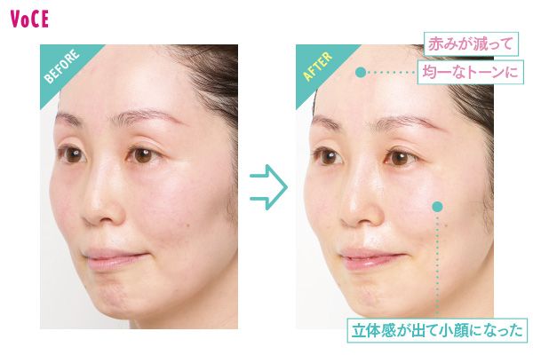 BEFORE→AFTER 赤みが減って均一なトーンに 立体感が出て小顔になった