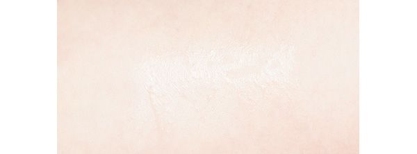 あと肌は？／ドクターシーラボ VC100エッセンスローションEX