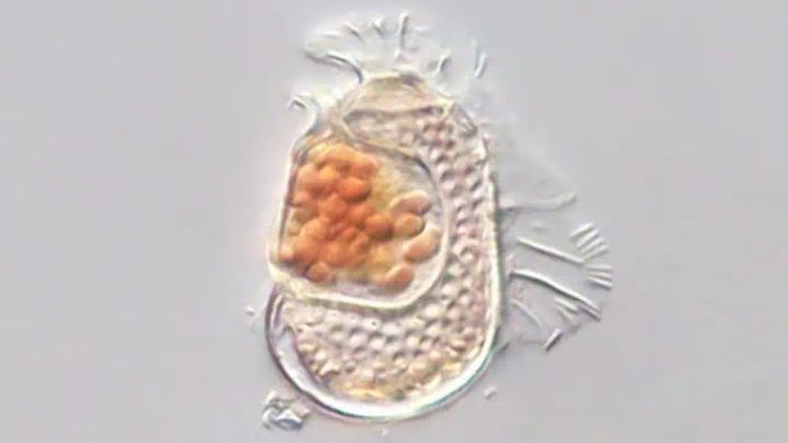生命と非生命の境界線をまたぐ謎の古細菌を発見
