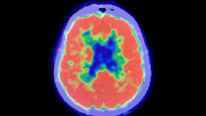 シェイクスピアの悲劇が現実に—『オセロ症候群』とは何か