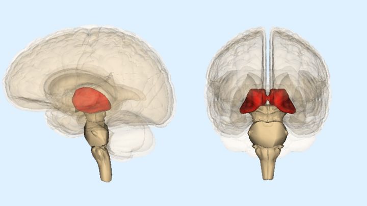 脳卒中が『根拠なき嫉妬』を引き起こす理由