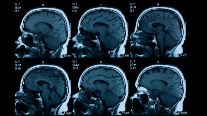 薬物リスクは才能の裏返しになり得る