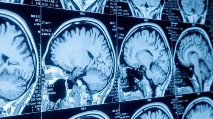 薬物に手を伸ばす子ども、脳に共通する「意外な特徴」