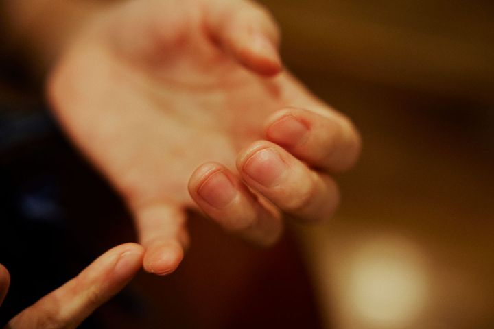 渡邊ゆかりさんの手