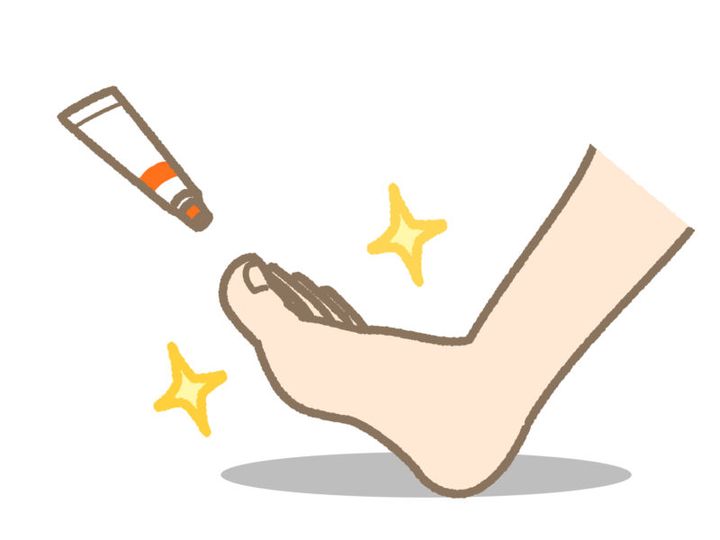 水虫になったらしっかり治療を