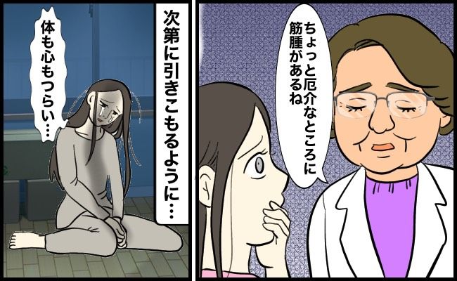 子宮筋腫治療で心身ともに苦しんだ女性