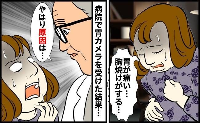 40代で胃炎、ピロリ菌と腫瘍が見つかった女性