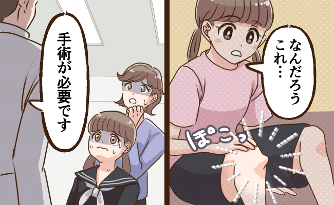 中学生で骨腫瘍、全身麻酔手術をした女性