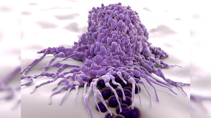 免疫の裏切りを利用する新しいがん治療への道筋