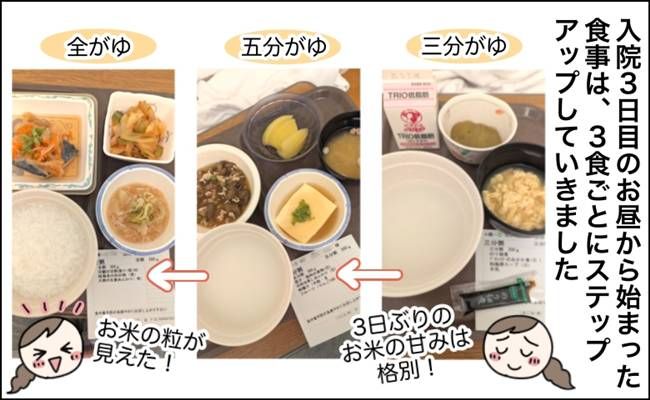 突然の腹痛から大腸憩室炎が判明した女性