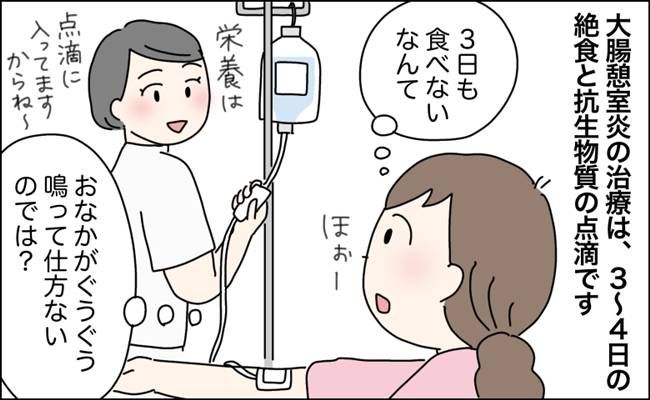 突然の腹痛から大腸憩室炎が判明した女性