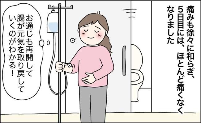 突然の腹痛から大腸憩室炎が判明した女性