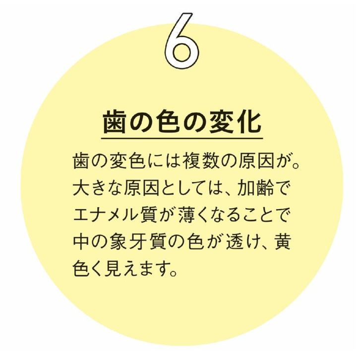 40代からの口腔内の変化⑥歯の色の変化