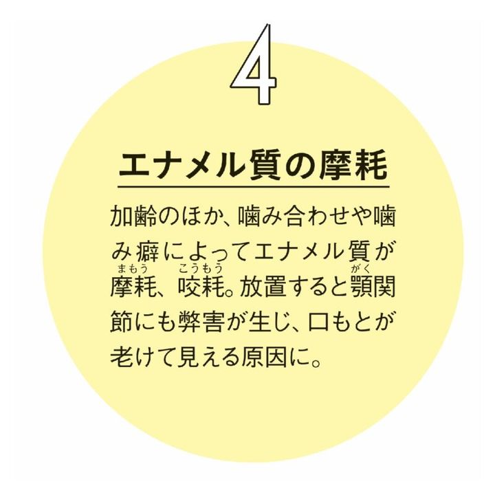 40代からの口腔内の変化④エナメル質の摩耗