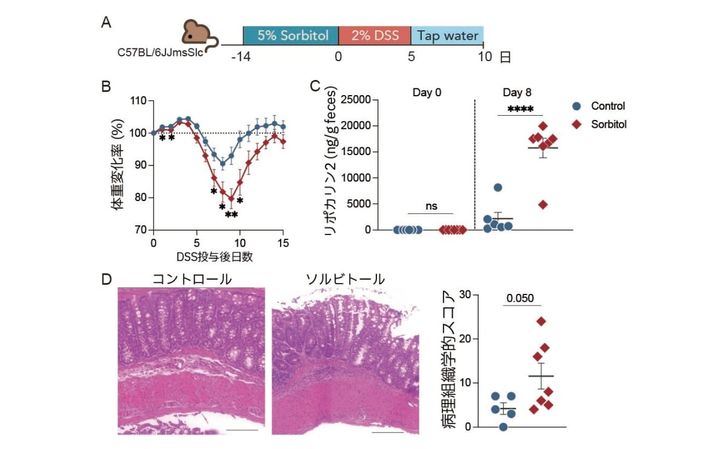 人工甘味料ソルビトールが腸の炎症を悪化させる衝撃の仕組みが判明
