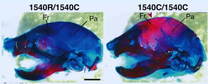 頭蓋骨が大きく変化しているのがわかる