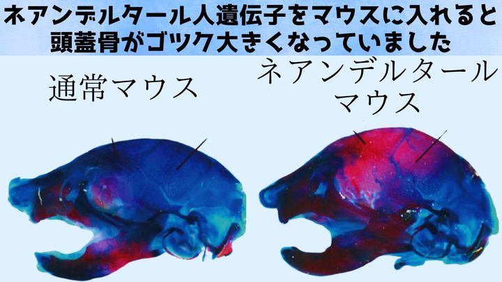 ネアンデルタール人のDNAをマウスに注入したら骨格に予期せぬ変化が発生