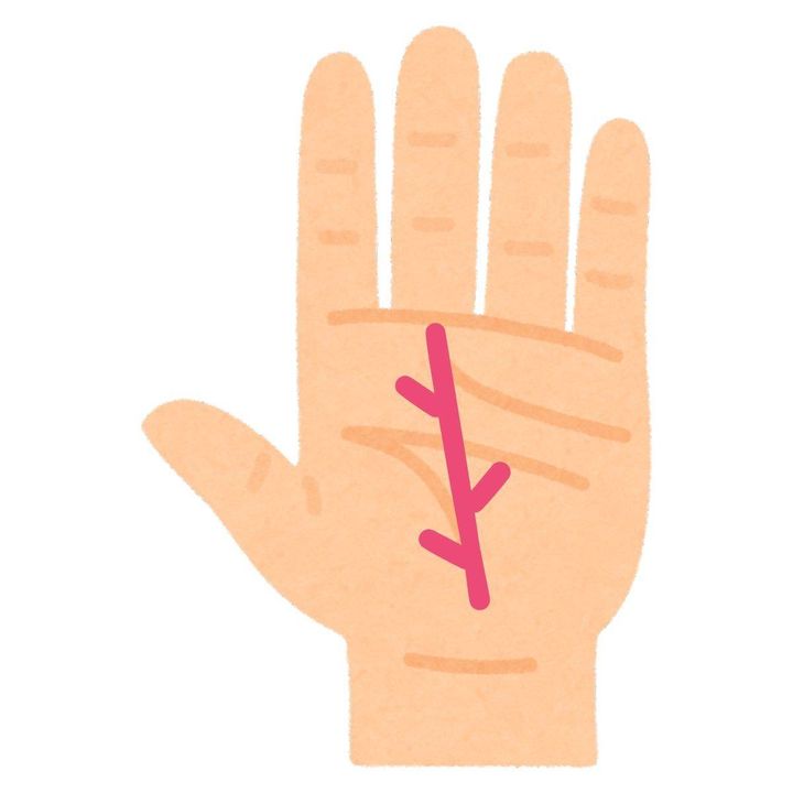 運命線から上向きに伸びる開運線