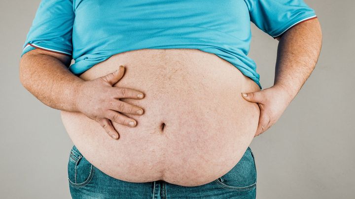 なぜ同じBMIでも健康度が違うのか──肥満の遺伝子研究最前線