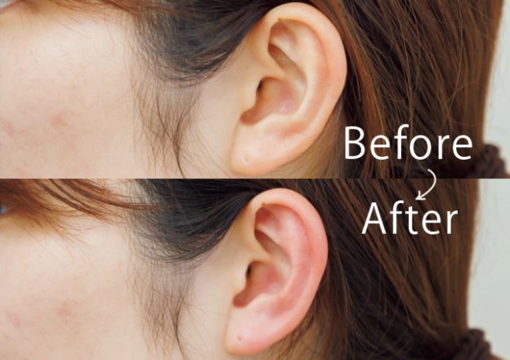 耳ツボジュエリー