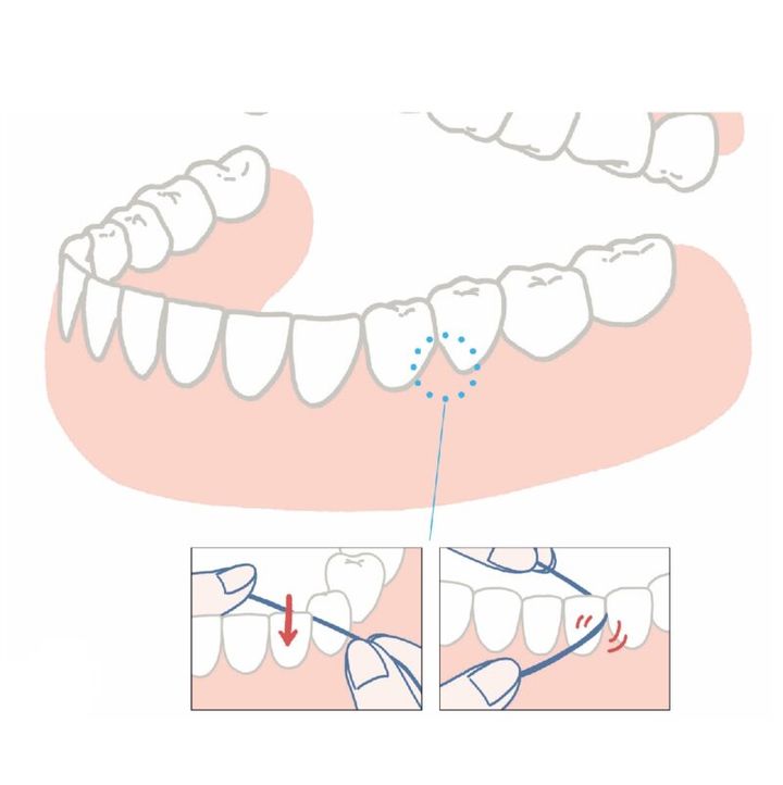 歯と歯の間はデンタルフロスで磨く
