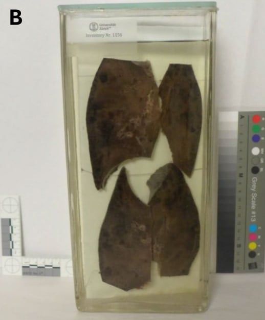 ホルマリン漬けにされた犠牲者の肺