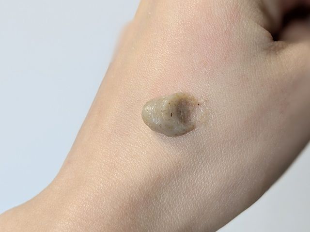 スクラブの写真