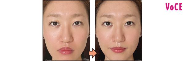 使ったらこうなる！／マイトレックス ミライワン