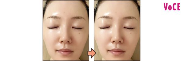 使ったらこうなる！／ステラボーテ レーザー ＆ EMS リフトブラシ PRO