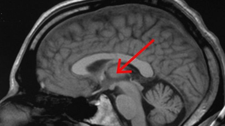 脳の中にあった感覚の『ボリューム調整つまみ』