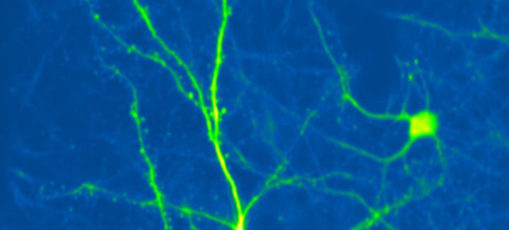 感覚の『揺らぎ』はなぜ起こる？脳科学が迫った長年の謎