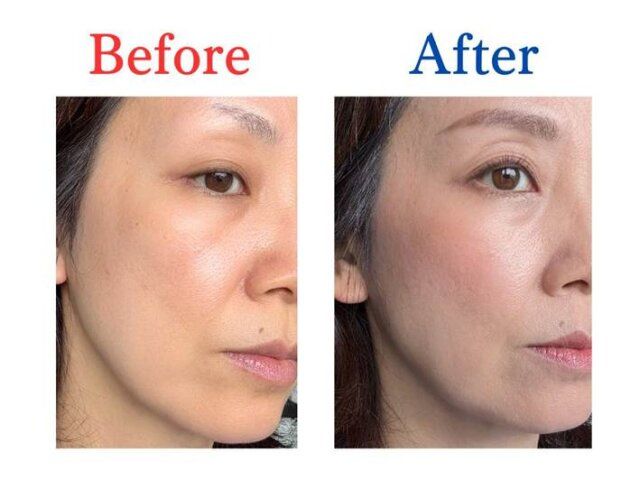 仕上がり ビフォー アフター