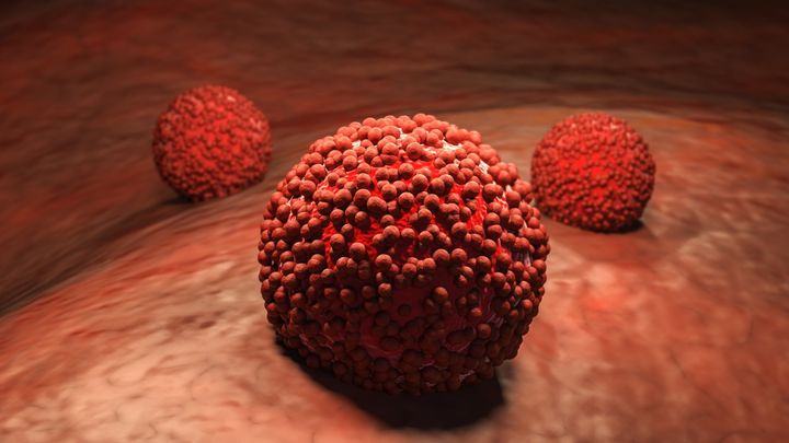 無害なウイルスが、皮膚がんを暴走させる仕組み