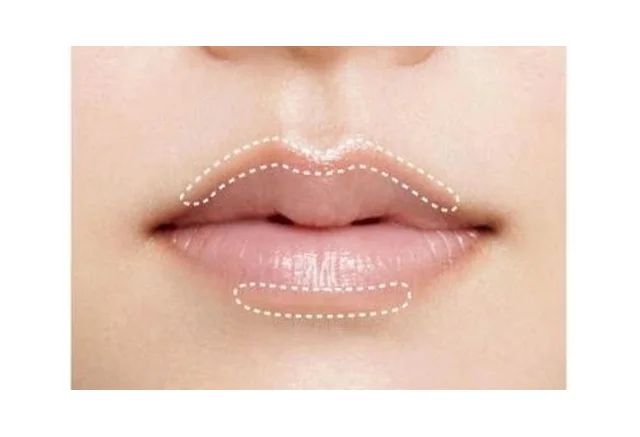 欲張りオーバーリップ BEFORE