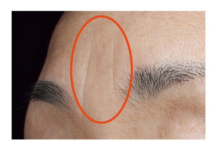 部分の定着ジワ