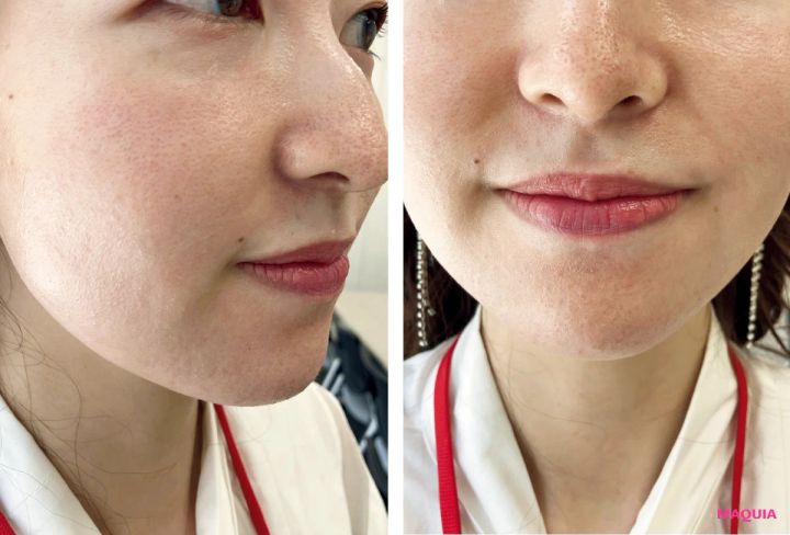 マキア 毛穴 皮脂 スキンケア 肌の状態