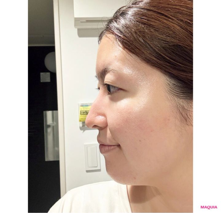 マキア 毛穴 皮脂 スキンケア 肌の状態 2