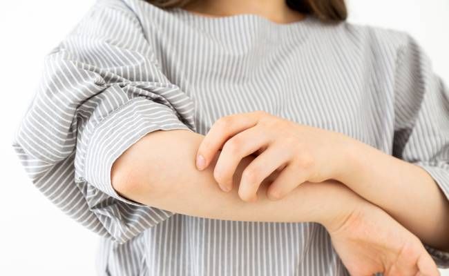 肌を掻く女性のイメージ