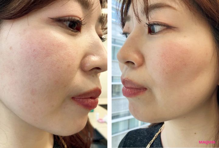 マキア 毛穴ケア おすすめ 乾燥肌 赤み 肌状態