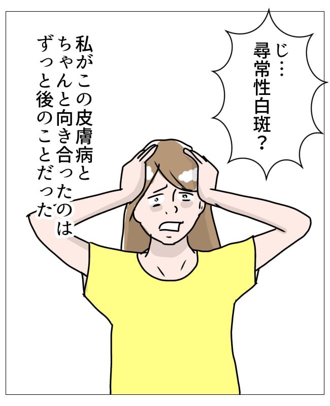 娘の尋常性白斑／フワリー