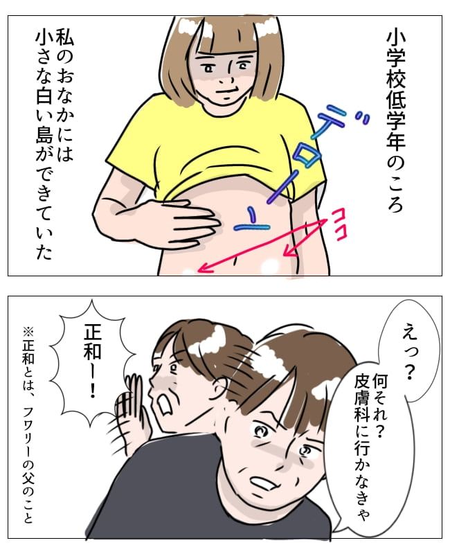 娘の尋常性白斑／フワリー