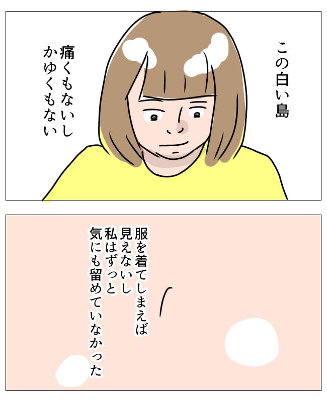 娘の尋常性白斑／フワリー
