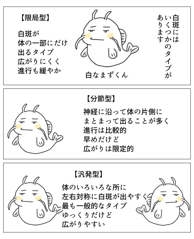 娘の尋常性白斑／フワリー