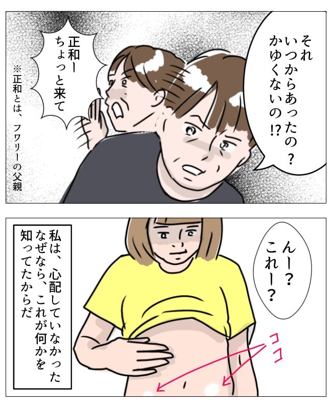 娘の尋常性白斑／フワリー