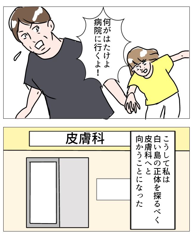 娘の尋常性白斑／フワリー