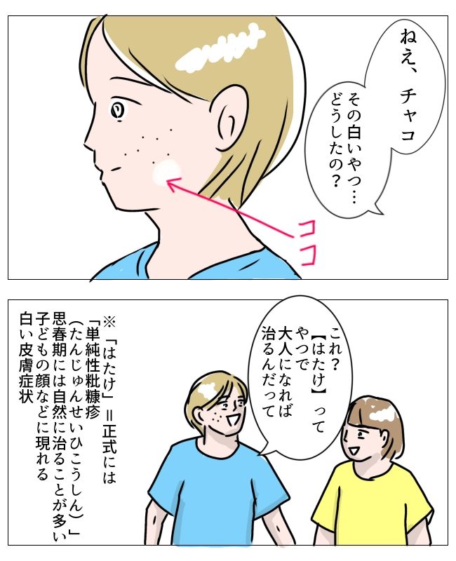娘の尋常性白斑／フワリー